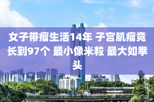 女子帶瘤生活14年 子宮肌瘤竟長(zhǎng)到97個(gè) 最小液壓動(dòng)力機(jī)械,元件制造像米粒 最大如拳頭